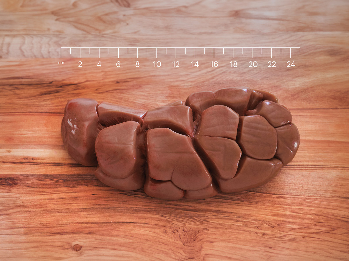 Beef Kidney 